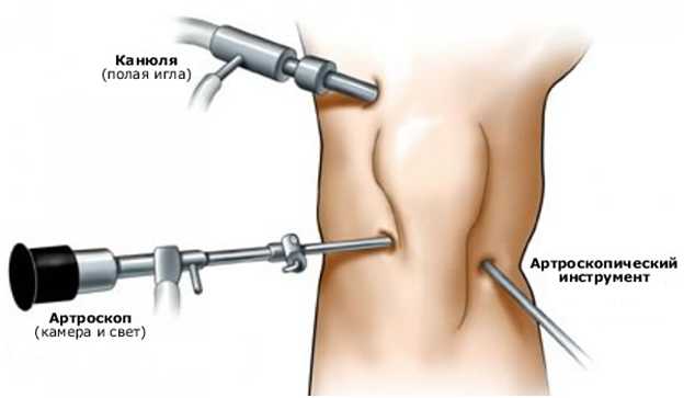 Артроз коленного сустава лечение алматы thumbnail